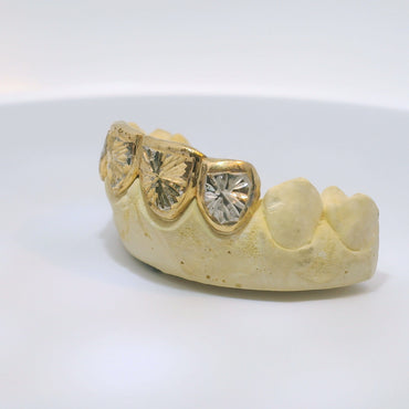 Two Tone 10K Diamond Cut Grillz image 1